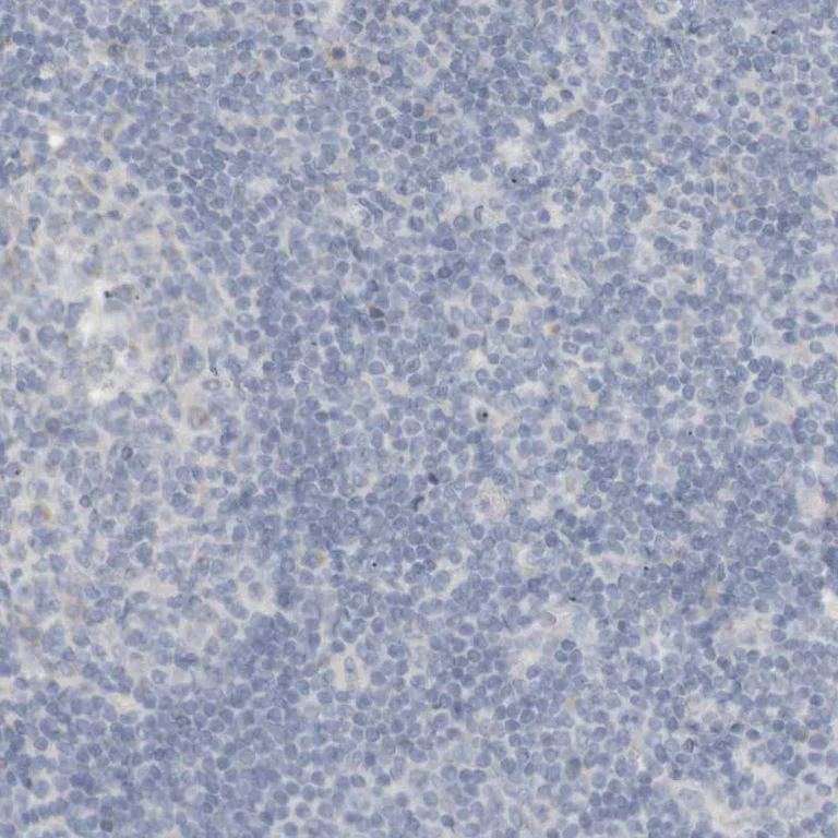 Immunohistochemistry (Formalin/PFA-fixed paraffin-embedded sections) - Anti-RTN3/HAP antibody (AB246911)