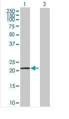 Western blot - Anti-RTN3/HAP antibody (AB68328)