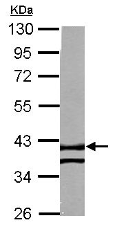 Western blot - Anti-RTN4IP1 antibody (AB155304), expandable thumbnail