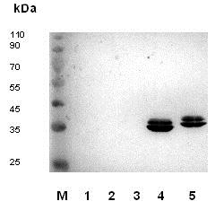 Western blot - Anti-Rubella Virus capsid antibody [9B11] (AB34749), expandable thumbnail