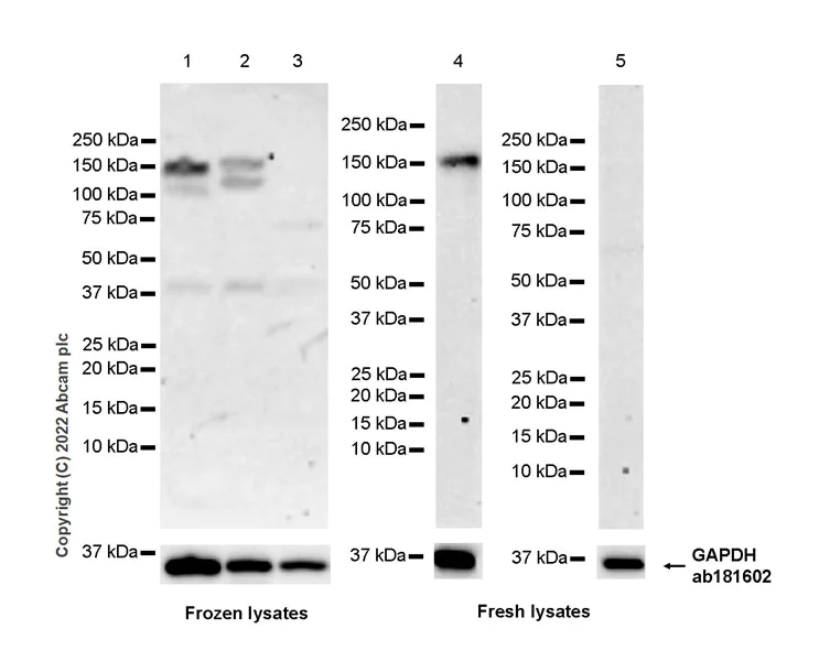 Western blot - Anti-Rubicon/Baron antibody [EPR26996-20] (AB307720)