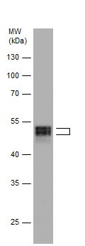 Western blot - Anti-RUNX1 / AML1 antibody (AB229482), expandable thumbnail