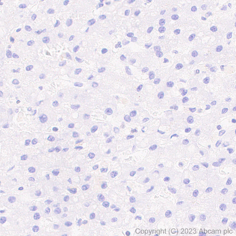 Immunohistochemistry (Formalin/PFA-fixed paraffin-embedded sections) - Anti-RUNX1 / AML1 antibody [RM1089] (AB315398)