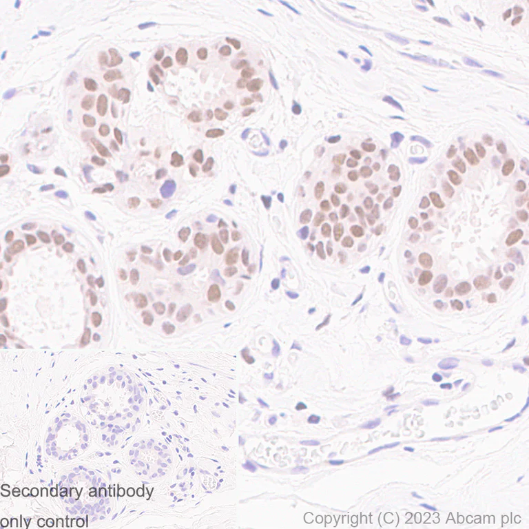 Immunohistochemistry (Formalin/PFA-fixed paraffin-embedded sections) - Anti-RUNX1 / AML1 antibody [RM1089] - BSA and Azide free (AB315399)