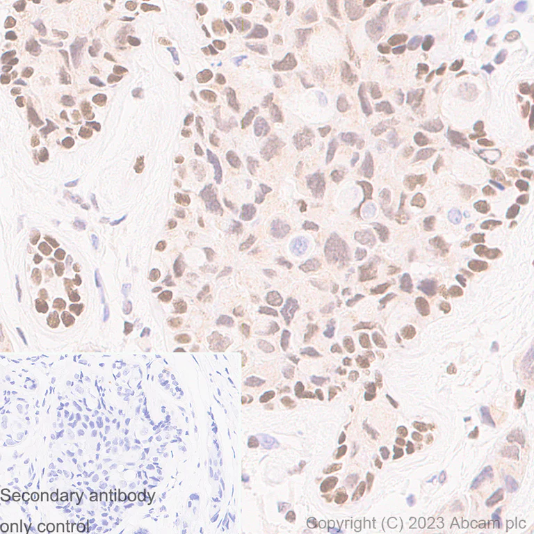 Immunohistochemistry (Formalin/PFA-fixed paraffin-embedded sections) - Anti-RUNX1 / AML1 antibody [RM1089] - BSA and Azide free (AB315399)