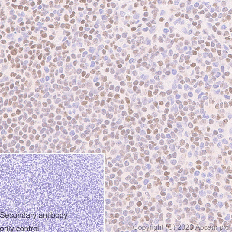 Immunohistochemistry (Formalin/PFA-fixed paraffin-embedded sections) - Anti-RUNX1 / AML1 antibody [RM1089] - BSA and Azide free (AB315399)