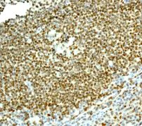 Immunohistochemistry (Formalin/PFA-fixed paraffin-embedded sections) - Anti-RUNX1 / AML1 + RUNX3 + RUNX2 antibody [EPR3099] - BSA and Azide free (AB220117)