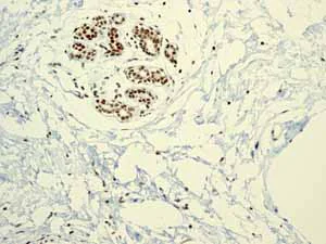 Immunohistochemistry (Formalin/PFA-fixed paraffin-embedded sections) - Anti-RUNX1 / AML1+RUNX3+RUNX2 antibody [EPR3098] - BSA and Azide free (AB248432)