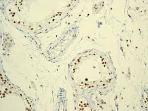Immunohistochemistry (Formalin/PFA-fixed paraffin-embedded sections) - Anti-RUNX1 / AML1+RUNX3+RUNX2 antibody [EPR3098] - BSA and Azide free (AB248432), expandable thumbnail