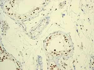 Immunohistochemistry (Formalin/PFA-fixed paraffin-embedded sections) - Anti-RUNX1 / AML1+RUNX3+RUNX2 antibody [EPR3098] - BSA and Azide free (AB248432)