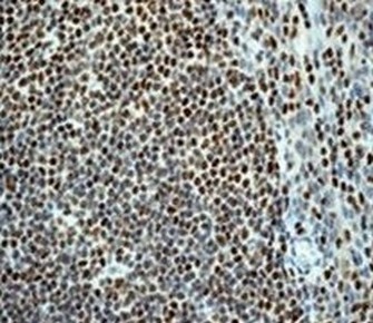 Immunohistochemistry (Formalin/PFA-fixed paraffin-embedded sections) - Anti-RUNX1 / AML1+RUNX3+RUNX2 antibody [EPR3098] - BSA and Azide free (AB248432), expandable thumbnail