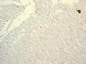 Immunohistochemistry (Formalin/PFA-fixed paraffin-embedded sections) - Anti-RUNX1 / AML1+RUNX3+RUNX2 antibody [EPR3098] - BSA and Azide free (AB248432), expandable thumbnail