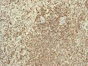 Immunohistochemistry (Formalin/PFA-fixed paraffin-embedded sections) - Anti-RUNX1 / AML1+RUNX3+RUNX2 antibody [EPR3098] - BSA and Azide free (AB248432), expandable thumbnail