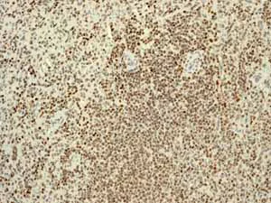 Immunohistochemistry (Formalin/PFA-fixed paraffin-embedded sections) - Anti-RUNX1 / AML1+RUNX3+RUNX2 antibody [EPR3098] - BSA and Azide free (AB248432)