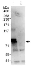 Immunoprecipitation - Anti-RUNX1T1/ETO/CDR antibody (AB124269)