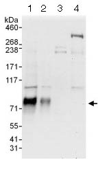 Western blot - Anti-RUNX1T1/ETO/CDR antibody (AB124269)