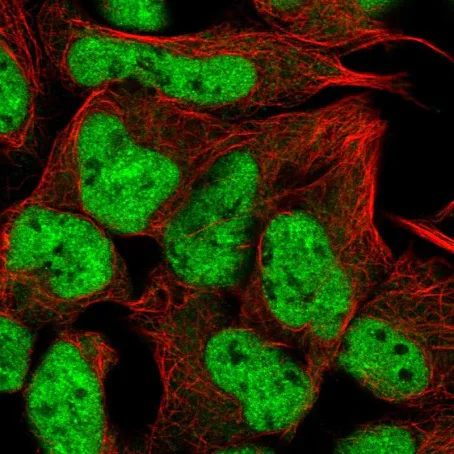 Immunocytochemistry/ Immunofluorescence - Anti-RUNX1T1/ETO/CDR antibody (AB220347)