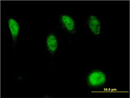 Immunocytochemistry/ Immunofluorescence - Anti-RUNX2 antibody [2B9] (AB76956), expandable thumbnail