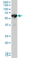 Western blot - Anti-RUNX2 antibody [2B9] (AB76956), expandable thumbnail