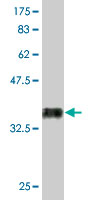 Western blot - Anti-RUNX2 antibody [2B9] (AB76956), expandable thumbnail