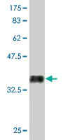 Western blot - Anti-RUNX2 antibody [2B9] (AB76956)