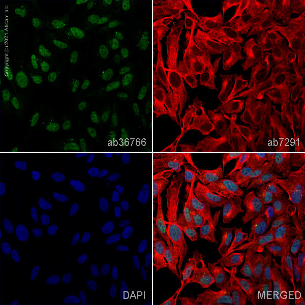 Immunocytochemistry - Anti-RUNX2 antibody (AB114133), expandable thumbnail