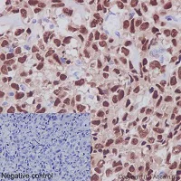 Immunohistochemistry (Formalin/PFA-fixed paraffin-embedded sections) - Anti-RUNX2 antibody [EPR14334] (AB192256)