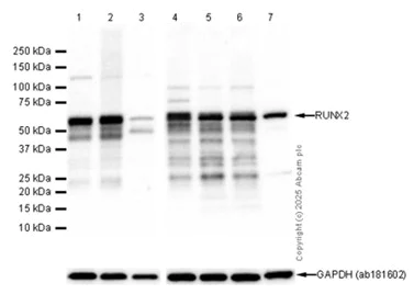 Western blot - Anti-RUNX2 antibody [EPR14334] (AB192256)