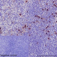 Immunohistochemistry (Formalin/PFA-fixed paraffin-embedded sections) - Anti-RUNX2 antibody [EPR14334] - BSA and Azide free (AB240329), expandable thumbnail