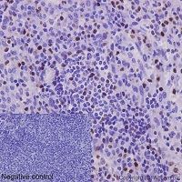 Immunohistochemistry (Formalin/PFA-fixed paraffin-embedded sections) - Anti-RUNX2 antibody [EPR14334] - BSA and Azide free (AB240329), expandable thumbnail