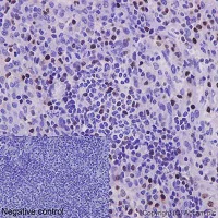 Immunohistochemistry (Formalin/PFA-fixed paraffin-embedded sections) - Anti-RUNX2 antibody [EPR14334] - BSA and Azide free (AB240329)