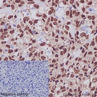 Immunohistochemistry (Formalin/PFA-fixed paraffin-embedded sections) - Anti-RUNX2 antibody [EPR14334] - BSA and Azide free (AB240329), expandable thumbnail