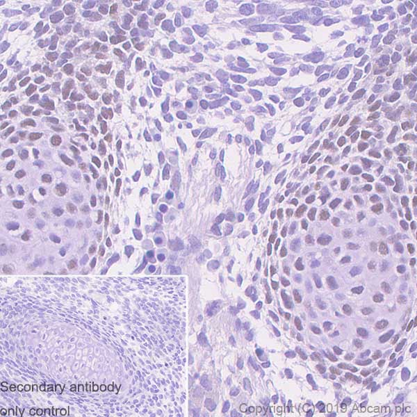 Immunohistochemistry (Formalin/PFA-fixed paraffin-embedded sections) - Anti-RUNX2 antibody [EPR22858-106] - BSA and Azide free (AB264077), expandable thumbnail