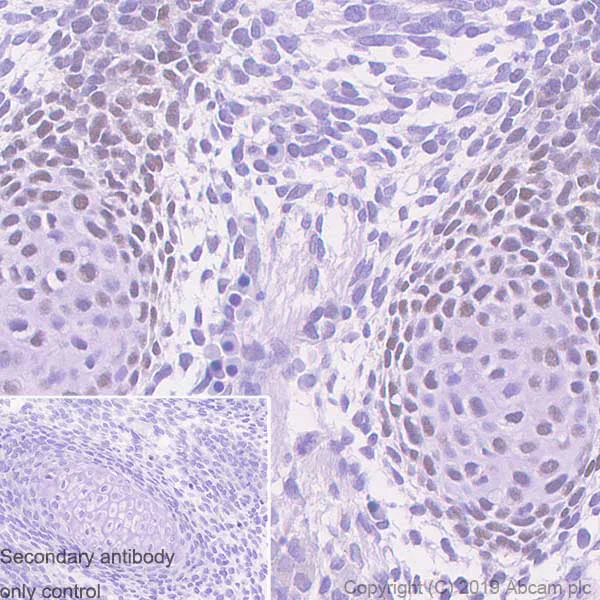 Immunohistochemistry (Formalin/PFA-fixed paraffin-embedded sections) - Anti-RUNX2 antibody [EPR22858-106] - BSA and Azide free (AB264077)