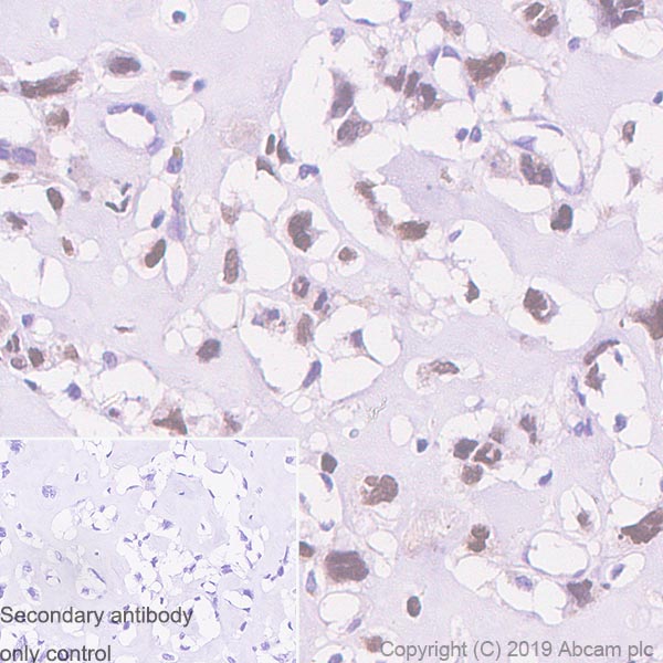 Immunohistochemistry (Formalin/PFA-fixed paraffin-embedded sections) - Anti-RUNX2 antibody [EPR22858-106] - BSA and Azide free (AB264077), expandable thumbnail