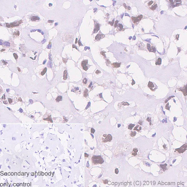 Immunohistochemistry (Formalin/PFA-fixed paraffin-embedded sections) - Anti-RUNX2 antibody [EPR22858-106] - BSA and Azide free (AB264077)