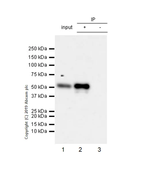 Immunoprecipitation - Anti-RUNX2 antibody [EPR22858-106] - ChIP Grade (AB236639)