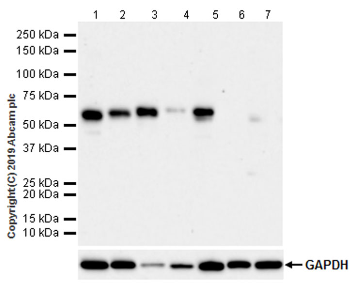 Western blot - Anti-RUNX2 antibody [EPR22858-106] - ChIP Grade (AB236639), expandable thumbnail
