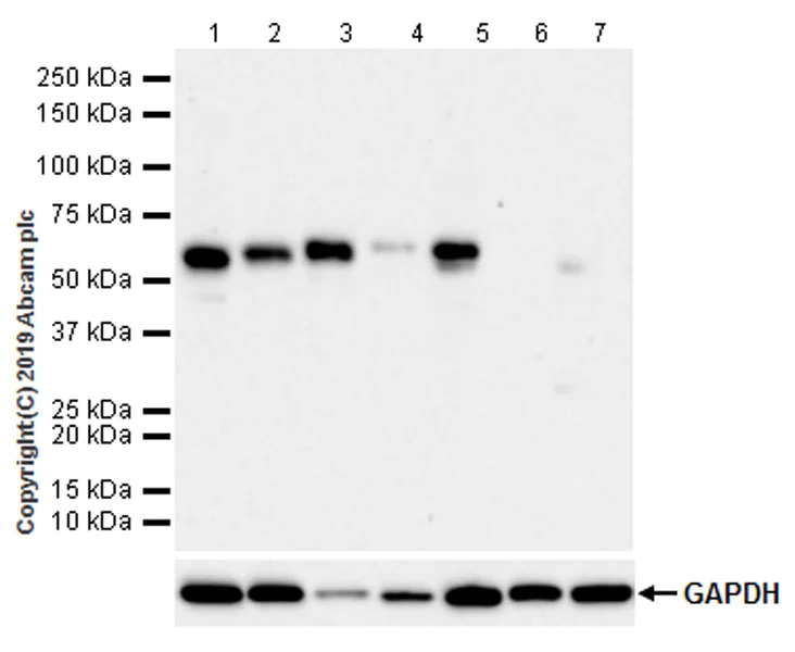 Western blot - Anti-RUNX2 antibody [EPR22858-106] - ChIP Grade (AB236639)