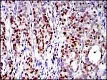 Immunohistochemistry (Formalin/PFA-fixed paraffin-embedded sections) - Anti-RUNX3 antibody [2B3] (AB135248), expandable thumbnail