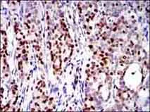 Immunohistochemistry (Formalin/PFA-fixed paraffin-embedded sections) - Anti-RUNX3 antibody [2B3] (AB135248)