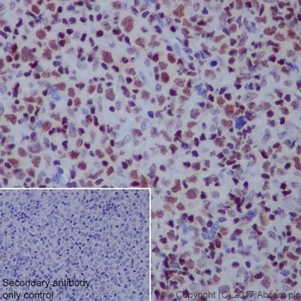 Immunohistochemistry (Formalin/PFA-fixed paraffin-embedded sections) - Anti-RUNX3 antibody [EPR20680] (AB224642)