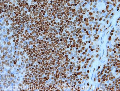 Immunohistochemistry (Formalin/PFA-fixed paraffin-embedded sections) - Anti-RUNX3 antibody [R3-5G4] - BSA and Azide free (AB264068)