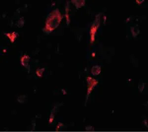 Immunohistochemistry (Formalin/PFA-fixed paraffin-embedded sections) - Anti-RUTBC1 antibody (AB139811)