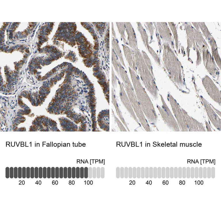 Immunohistochemistry (Formalin/PFA-fixed paraffin-embedded sections) - Anti-RUVBL1 Antibody (AB327199)