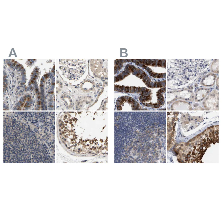 Immunohistochemistry (Formalin/PFA-fixed paraffin-embedded sections) - Anti-RUVBL1 Antibody (AB327199)