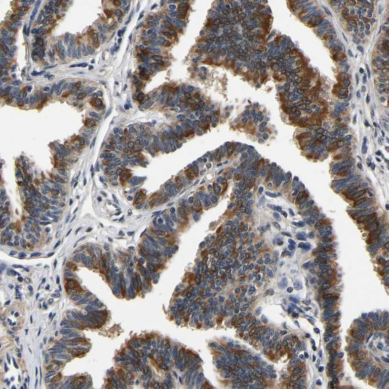 Immunohistochemistry (Formalin/PFA-fixed paraffin-embedded sections) - Anti-RUVBL1 Antibody (AB327199)