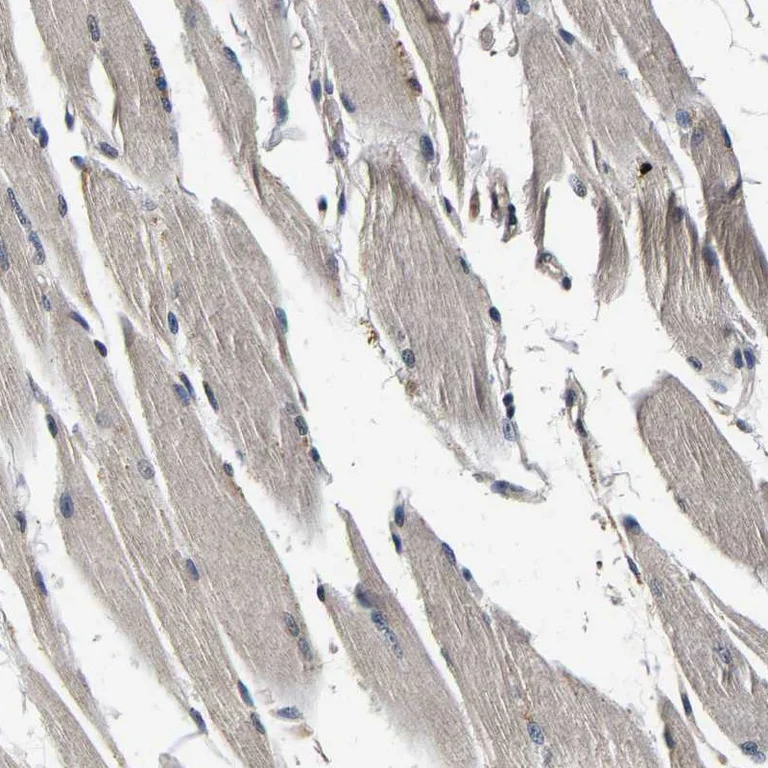 Immunohistochemistry (Formalin/PFA-fixed paraffin-embedded sections) - Anti-RUVBL1 Antibody (AB327199)