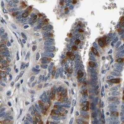 Immunohistochemistry (Formalin/PFA-fixed paraffin-embedded sections) - Anti-RUVBL1 Antibody (AB327199)