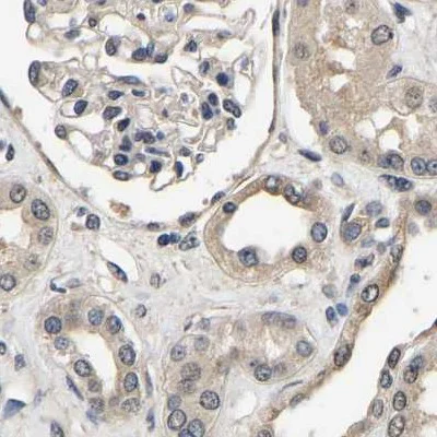 Immunohistochemistry (Formalin/PFA-fixed paraffin-embedded sections) - Anti-RUVBL1 Antibody (AB327199)